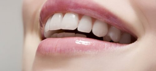 تجنّبوا هذه العادات بعد عمليّة تبييض الأسنان