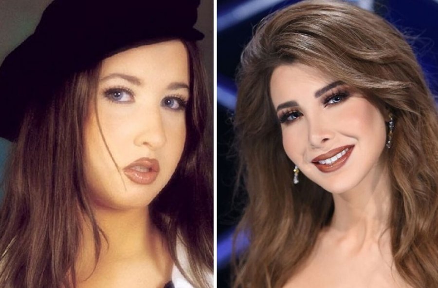 نانسي قبل وبعد عمليات التجميل ماد اسبوار لجراحة التجميل والجراحة العامَة